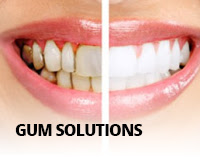 gum solution