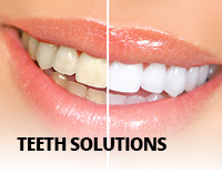 teeth solution